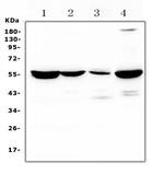 ASL Antibody in Western Blot (WB)