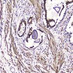 ATF4 Antibody in Immunohistochemistry (Paraffin) (IHC (P))