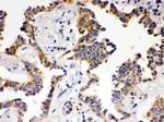 ATG14 Antibody in Immunohistochemistry (Paraffin) (IHC (P))