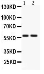 ATG14 Antibody in Western Blot (WB)