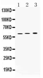 ATP4B Antibody in Western Blot (WB)