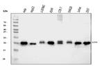 ATP5H Antibody in Western Blot (WB)