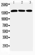 Ataxin 2 Antibody in Western Blot (WB)