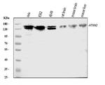 Ataxin 2 Antibody in Western Blot (WB)