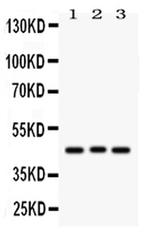 Ataxin 3 Antibody in Western Blot (WB)