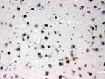 ADC Antibody in Immunohistochemistry (Paraffin) (IHC (P))