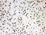 ADC Antibody in Immunohistochemistry (Paraffin) (IHC (P))