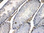 BAG1 Antibody in Immunohistochemistry (Paraffin) (IHC (P))