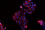 BAG2 Antibody in Immunocytochemistry (ICC/IF)