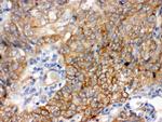 BAG3 Antibody in Immunohistochemistry (Paraffin) (IHC (P))