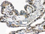 BIK Antibody in Immunohistochemistry (Paraffin) (IHC (P))