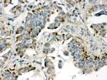 BMP5 Antibody in Immunohistochemistry (Paraffin) (IHC (P))