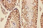 BRCA1 Antibody in Immunohistochemistry (Paraffin) (IHC (P))