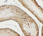 Bub3 Antibody in Immunohistochemistry (Paraffin) (IHC (P))