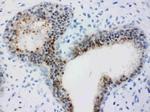 Bub3 Antibody in Immunohistochemistry (Paraffin) (IHC (P))