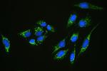 C1QBP Antibody in Immunocytochemistry (ICC/IF)