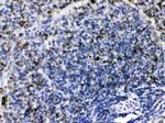 C1QBP Antibody in Immunohistochemistry (Paraffin) (IHC (P))