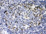 C1QBP Antibody in Immunohistochemistry (Paraffin) (IHC (P))