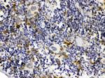 C1QBP Antibody in Immunohistochemistry (Paraffin) (IHC (P))