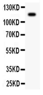 Complement C5a Antibody in Western Blot (WB)