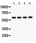 CADM1 Antibody in Western Blot (WB)