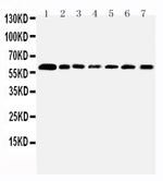 PRMT4 Antibody in Western Blot (WB)