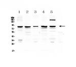 CARS Antibody in Western Blot (WB)