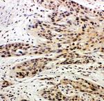 Caspase 14 Antibody in Immunohistochemistry (Paraffin) (IHC (P))