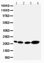 Caveolin 2 Antibody in Western Blot (WB)