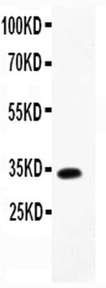 TARC Antibody in Western Blot (WB)