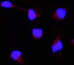 AAMP Antibody in Immunocytochemistry (ICC/IF)