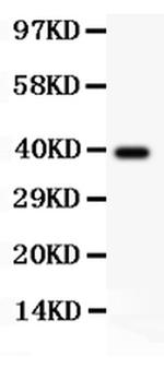 AAMP Antibody in Western Blot (WB)