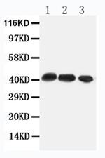 CCR4 Antibody in Western Blot (WB)