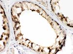 TCP-1 beta Antibody in Immunohistochemistry (Paraffin) (IHC (P))