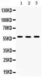 TCP-1 beta Antibody in Western Blot (WB)