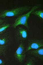 TCP-1 beta Antibody in Immunocytochemistry (ICC/IF)