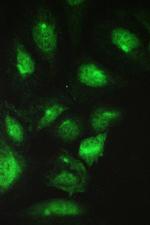 TCP-1 beta Antibody in Immunocytochemistry (ICC/IF)