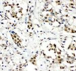 CCT3 Antibody in Immunohistochemistry (Paraffin) (IHC (P))