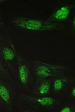 TCP1 epsilon Antibody in Immunocytochemistry (ICC/IF)