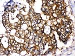 TCP1 epsilon Antibody in Immunohistochemistry (Paraffin) (IHC (P))