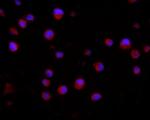 CD2AP Antibody in Immunocytochemistry (ICC/IF)