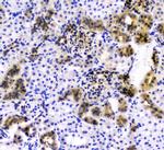 CD2AP Antibody in Immunohistochemistry (Paraffin) (IHC (P))