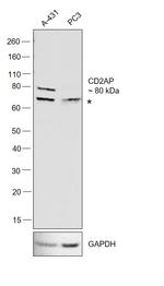 CD2AP Antibody in Western Blot (WB)