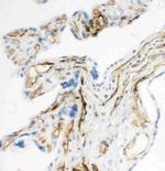 CD34 Antibody in Immunohistochemistry (Frozen) (IHC (F))