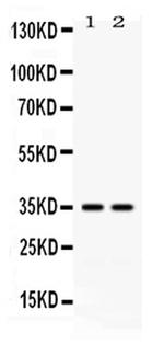 CD58 Antibody in Western Blot (WB)