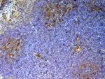 CD59 Antibody in Immunohistochemistry (Paraffin) (IHC (P))