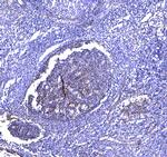 CD81 Antibody in Immunohistochemistry (Paraffin) (IHC (P))