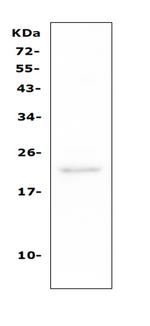 CD81 Antibody in Western Blot (WB)