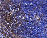 CD81 Antibody in Immunohistochemistry (Paraffin) (IHC (P))