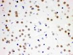 CDC25B Antibody in Immunohistochemistry (Paraffin) (IHC (P))